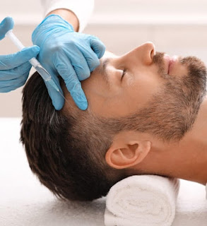 Frequently Asked Questions (FAQ) About Hair Transplantation