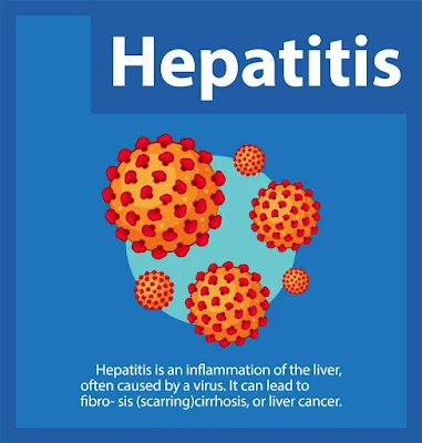 Breakthroughs in Hepatitis Treatment