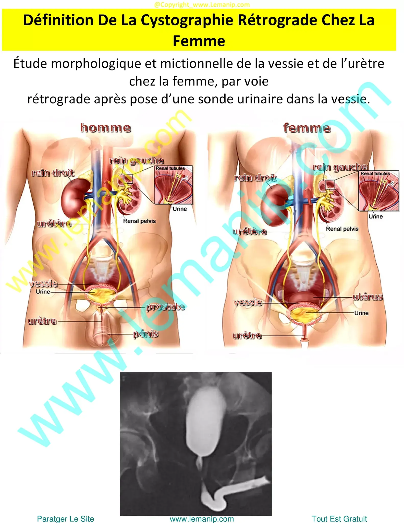 cystoscopy urethral dilation,cysto urethral dilation,cystoscopy and urethral dilation,cystoscopy ureteroscopy laser lithotripsy,cystoscopy ureteroscopy,cysto ureteroscopy,cystoscopy tube,cysto tube,cystoscopy and ureteroscopy,cystography