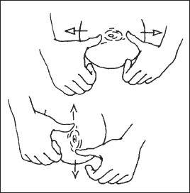 Hoffman technique adalah salah satu cara mengatasi flat nipple