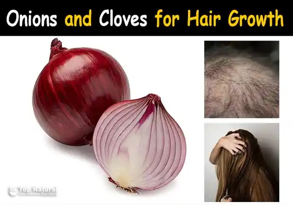 how to use cloves water for hair growth, can i use clove water on my hair everyday, cloves and flaxseed for hair growth, side effects of onion juice on hair, how to make clove oil for hair growth, ginger and clove for hair growth, cloves and rosemary for hair growth, 2 ways to use onions for hair growth, onion and clove for hair growth, cloves and onion for hair growth, onion and cloves for hair, clove and onion for hair