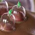 Cupping Therapy - Napoli