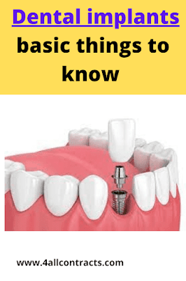 Dental implants are a moderately