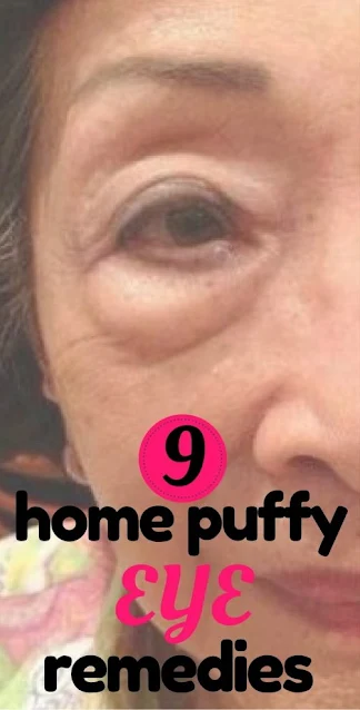 9 Home Puffy Eye Remedies