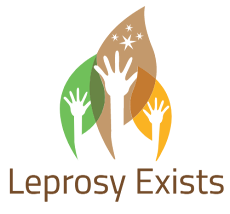 Do Leprosy Exist?