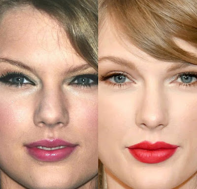 Taylor Swift plastic surgeries