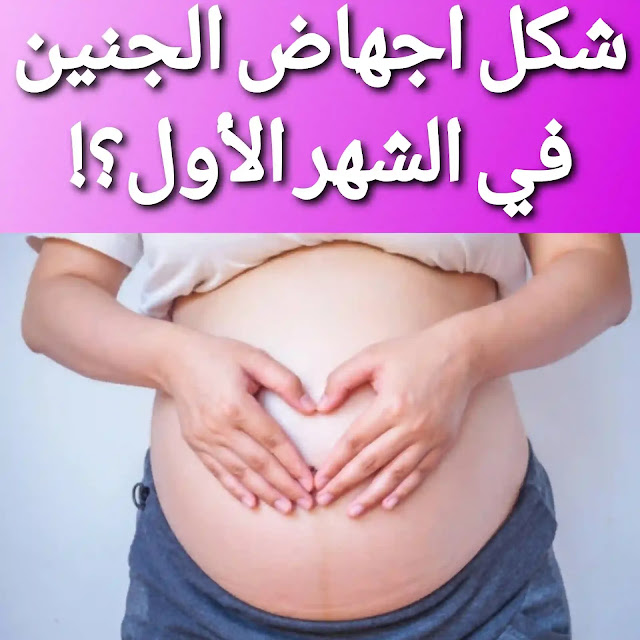 شكل إجهاض الجنين في الشهر الأول