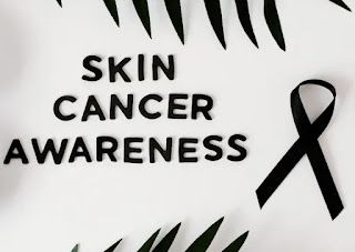 Who are the people most prone to getting skin cancer?- ichhori.com