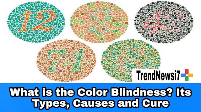 What is the Color Blindness? Its Types, Causes and Cure