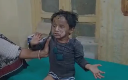 राजस्थान: कार में गैस रिफिल करते समय हुआ विस्फोट, तीन साल का बच्चा झुलसा