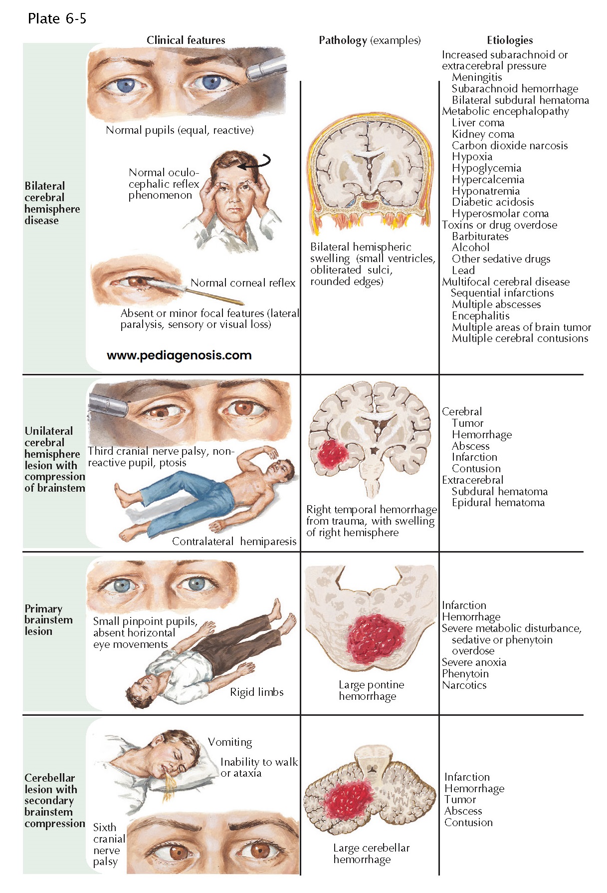 Differential Diagnosis of Coma