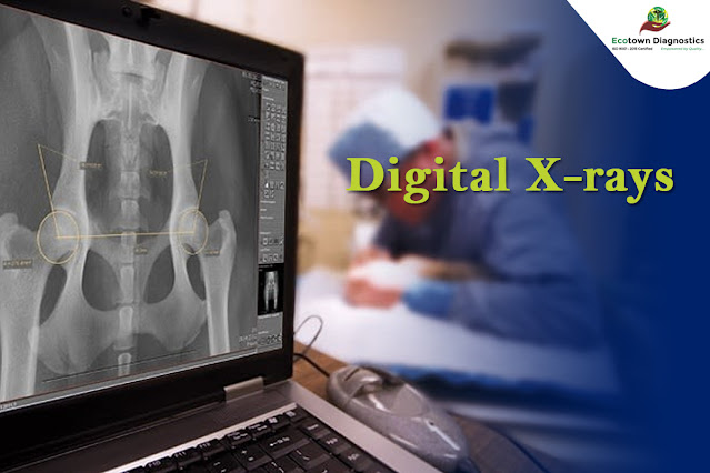 Digital X Ray In Bangalore