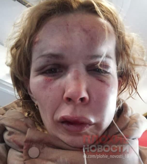 Гражданин Беларуси до полусмерти избил сотрудницу одного из ресторанов Ирину Валову, с которой ранее состоял в отношениях. 