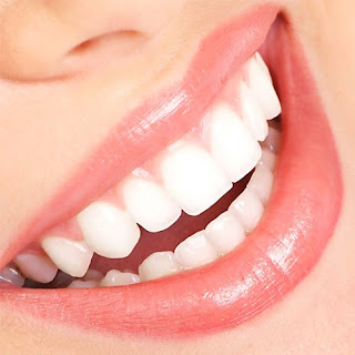 Quy trình tẩy trắng răng-2