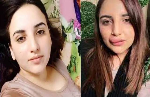 Why Lips of Hareem Shah are Swollen