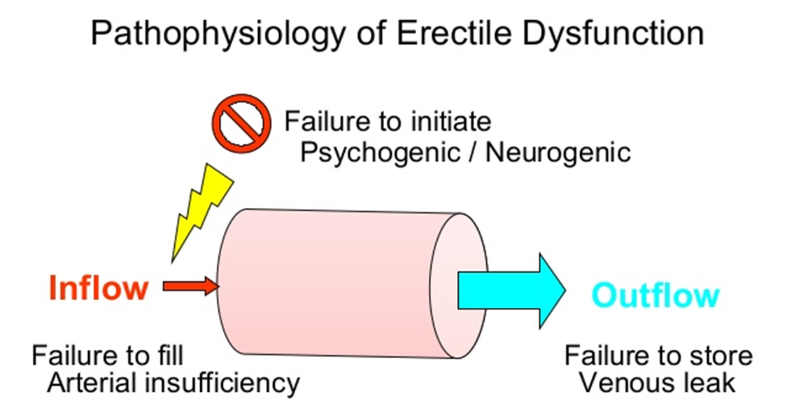 Pathophysiology of Erectile Dysfunction