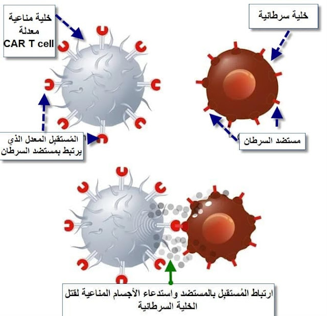 كيف يعمل العلاج المناعي للسرطان CAR T cell