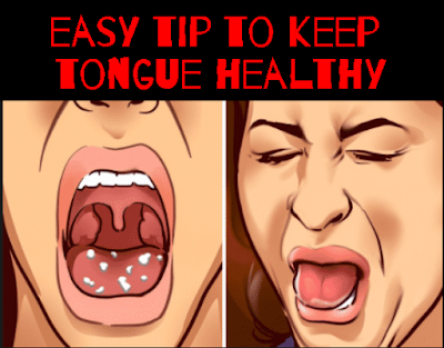 How to clean your tongue - Benefits of Tongue Scraping daily every night and morning-01