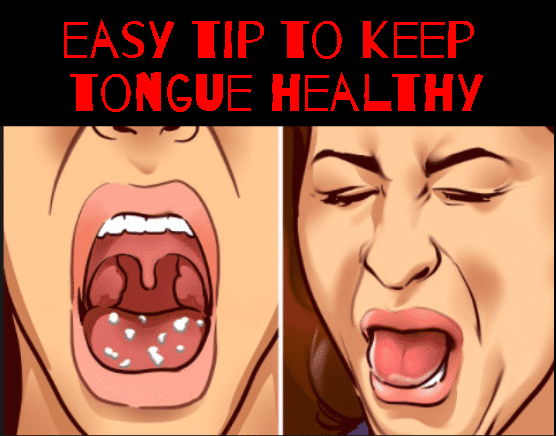 How to clean your tongue - Benefits of Tongue Scraping daily every night and morning