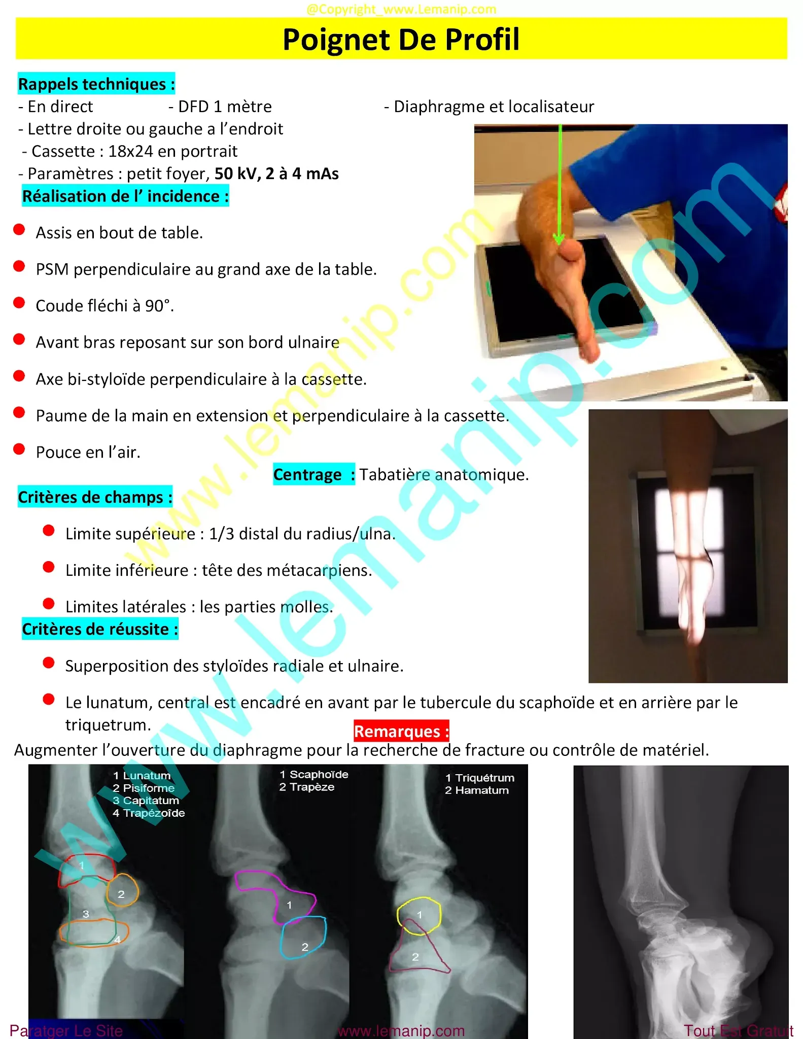 avant bras,elbow pain orthopedic doctor,dr henry hand and wrist,elbow pain treatment near me,premier orthopedics hand specialist,bras avant,hand man,orthopedic hand,orthopedic wrist,orthopedic elbow,orthopedic carpal tunnel