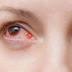 क्या आंखों से भी हो सकता है Corona Infection? जानिए एक्सपर्ट की राय