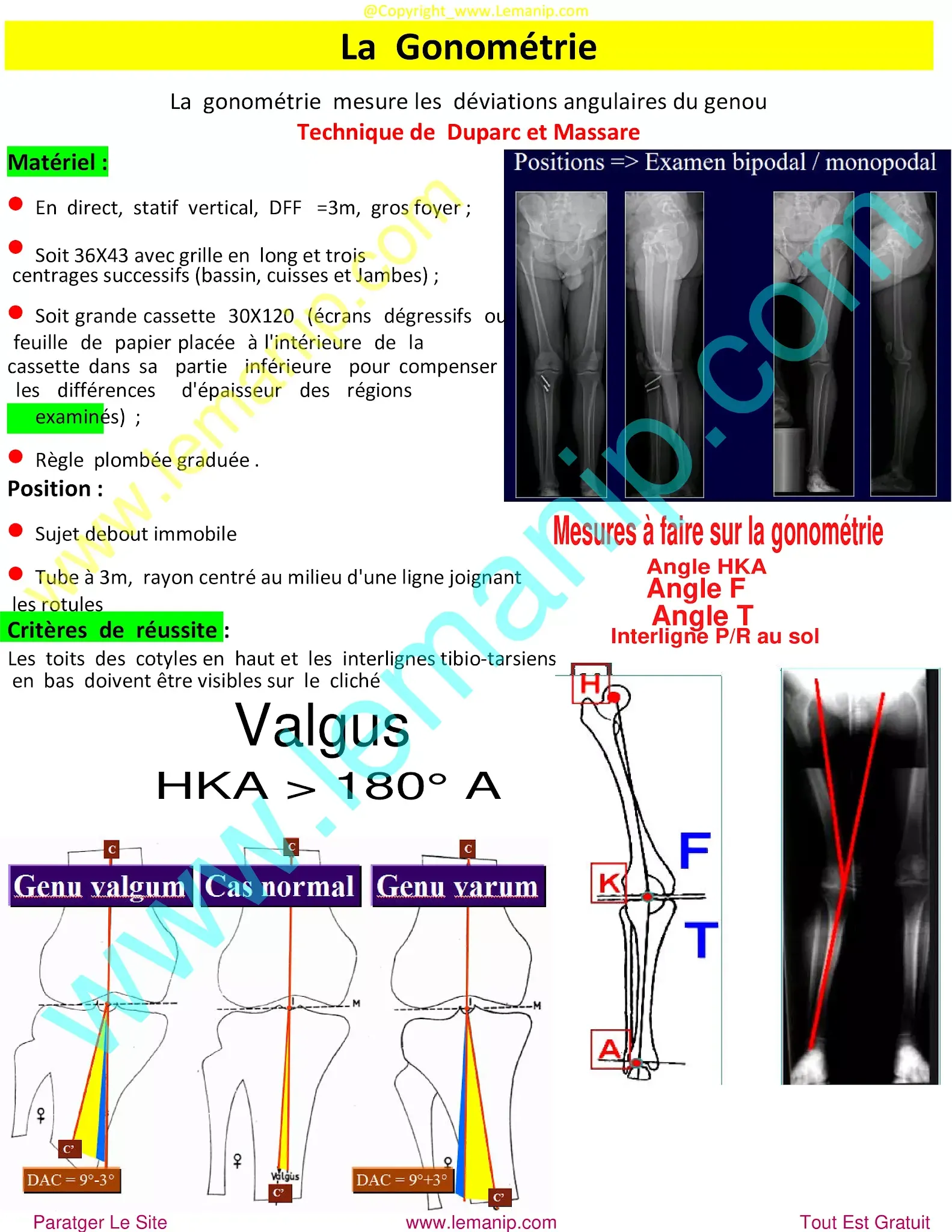 knee doctor,ball joint centre,short femur in fetus,lower ball joint replacement near me,intramedullary femur,femur pain after hip replacement,broken femur during hip replacement,medial patellofemoral ligament,mid thigh pain after hip replacement,knee dr