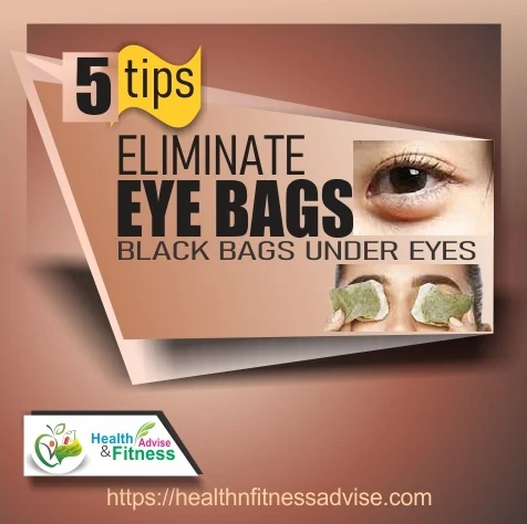 eyebag-black-bag-under-eyes-healthnfitnessadvise-com