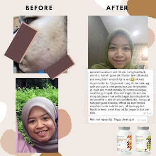 Testimoni Review Vitamin E Shaklee Untuk Wanita dan Lelaki