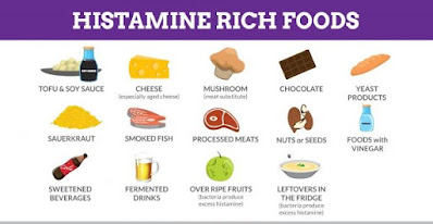 Avoid histamine