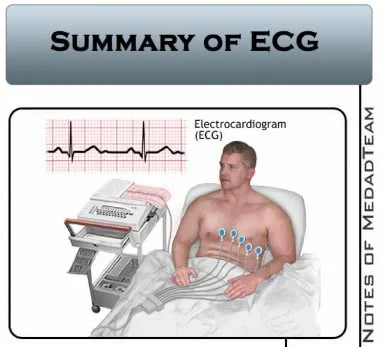 ملخص ecg