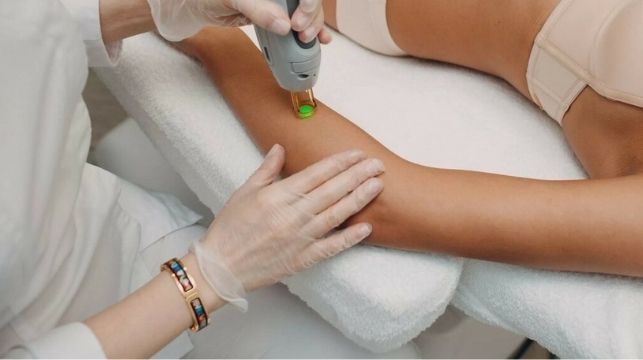 Benefits of Arm Laser Hair Removal