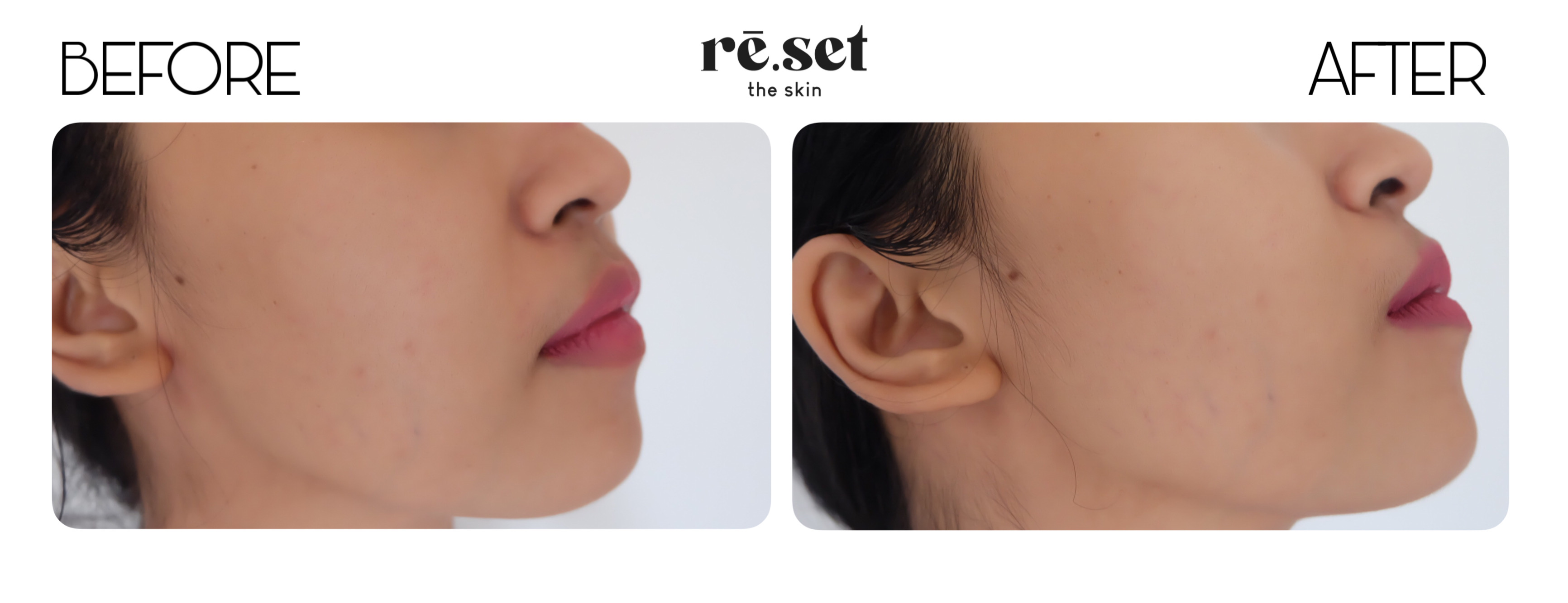 [Review] Reset The Skin, Skin Care Untuk Segala Permasalan Kulit