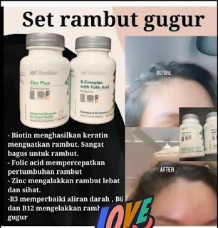 Rambut Gugur Terlalu Banyak Selepas Bersalin Ketika Hamil