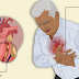 Alternative Herb Cure Heart Attack