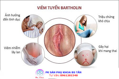 Viêm Tuyến Bartholin