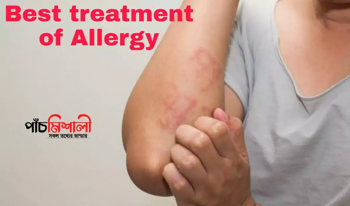 Allergies : Symptoms of allergies, cause and best treatment of allergies 2021