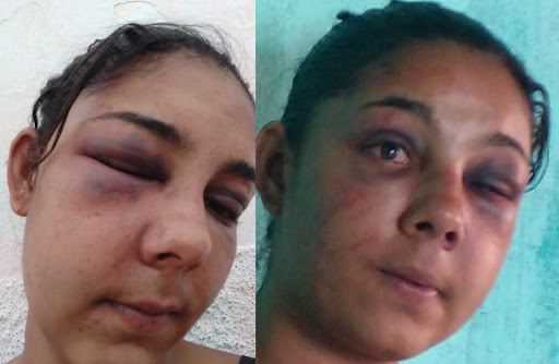 Mulher é brutalmente agredida pelo marido em Várzea Nova 