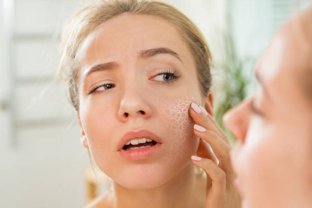 Unhappy girl standing looking in the mirror, checking dry irritated skin.