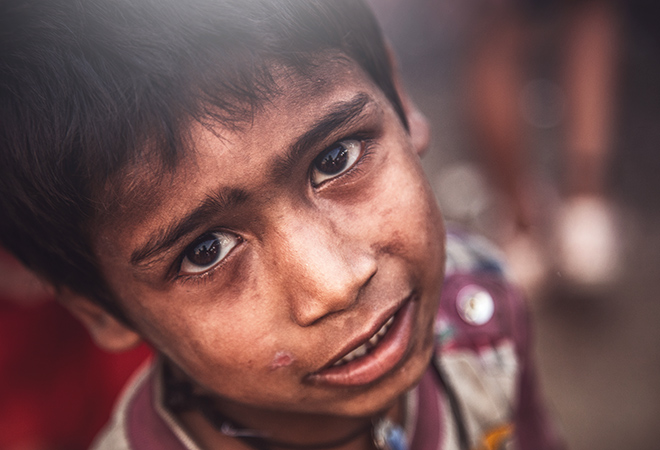 The Iranian people are weak and undernourished.