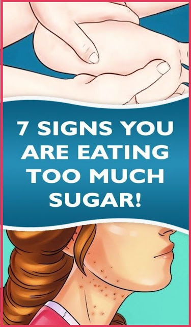 Seven Warning Signs You Are Eating Too Much Sugar