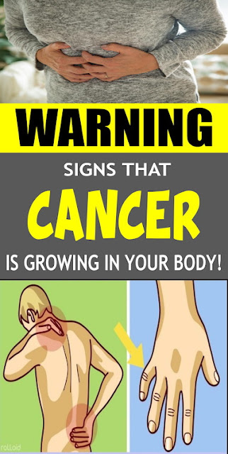 Early Cancer Signs Everyone Ignores !