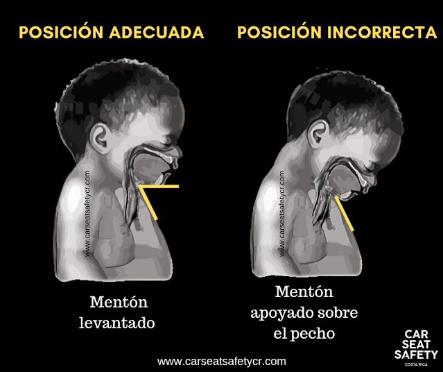 Cómo evitar la peligrosa asfixia postural en la silla del coche - CSC