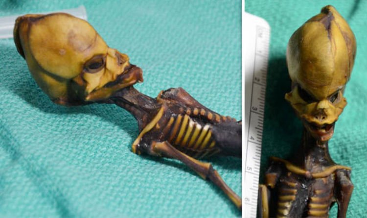 “Alien” From The Atacama Desert Turns Out To Be A Baby With Genetic Disorders