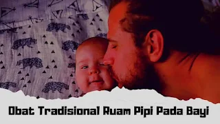 Obat Tradisional Ruam Pipi Pada Bayi