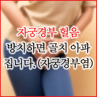 자궁경구 헐음 원인 확인하기 클릭