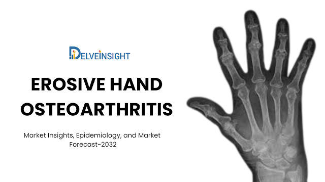 Erosive Hand Osteoarthritis Market