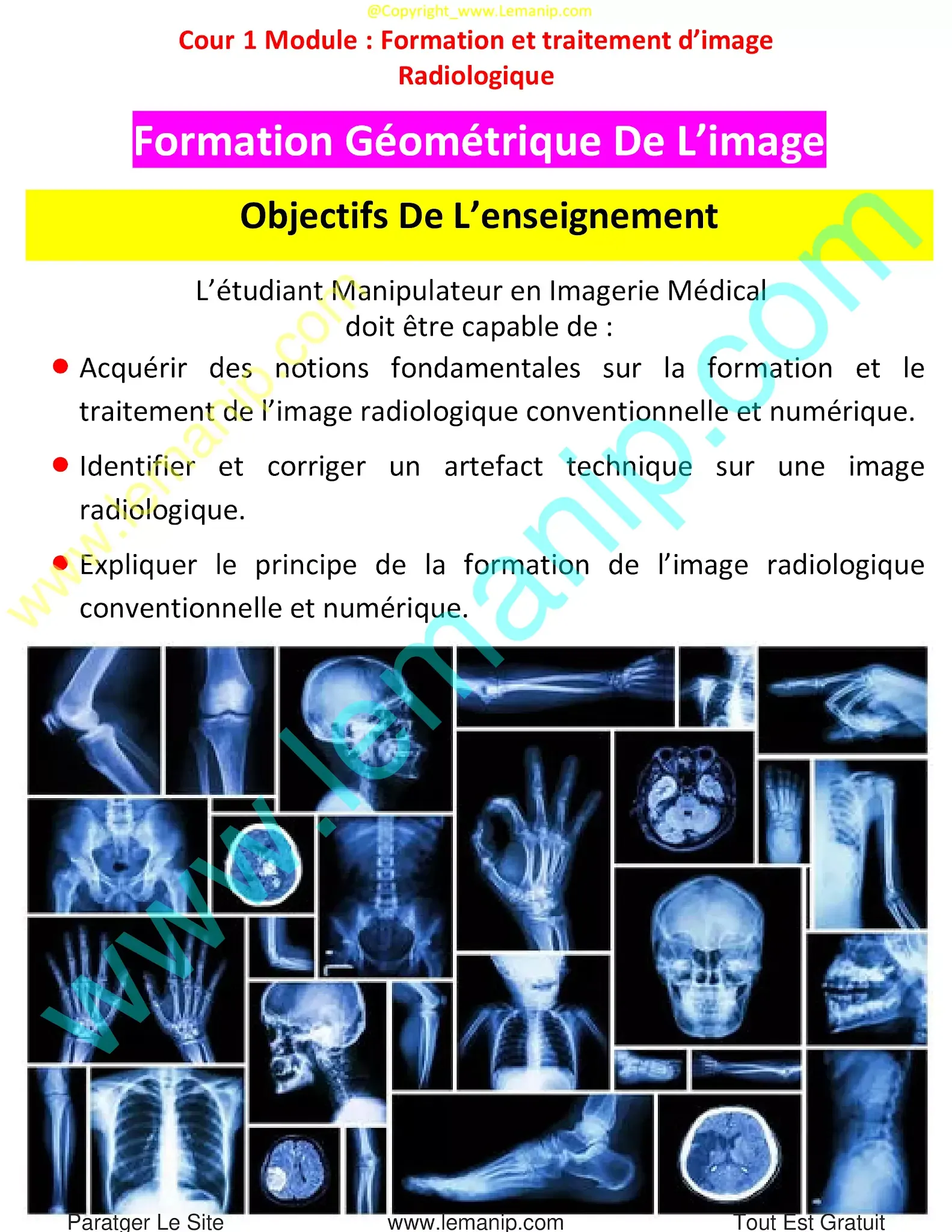 Objectifs Du Module : Formation et Traitement D’image Radiologique