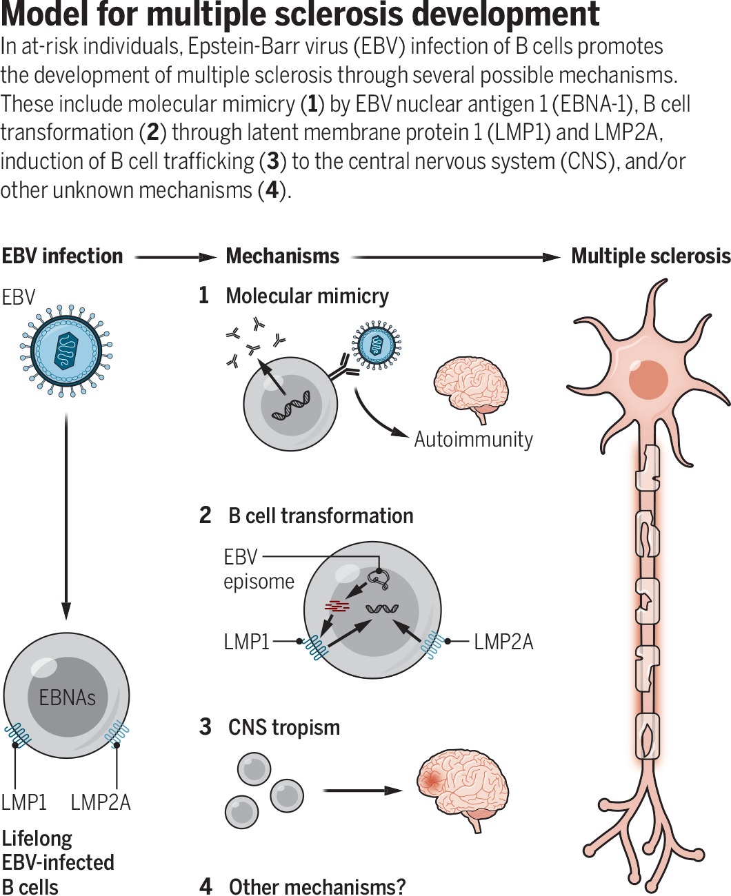 Model for multiple sclerosis development