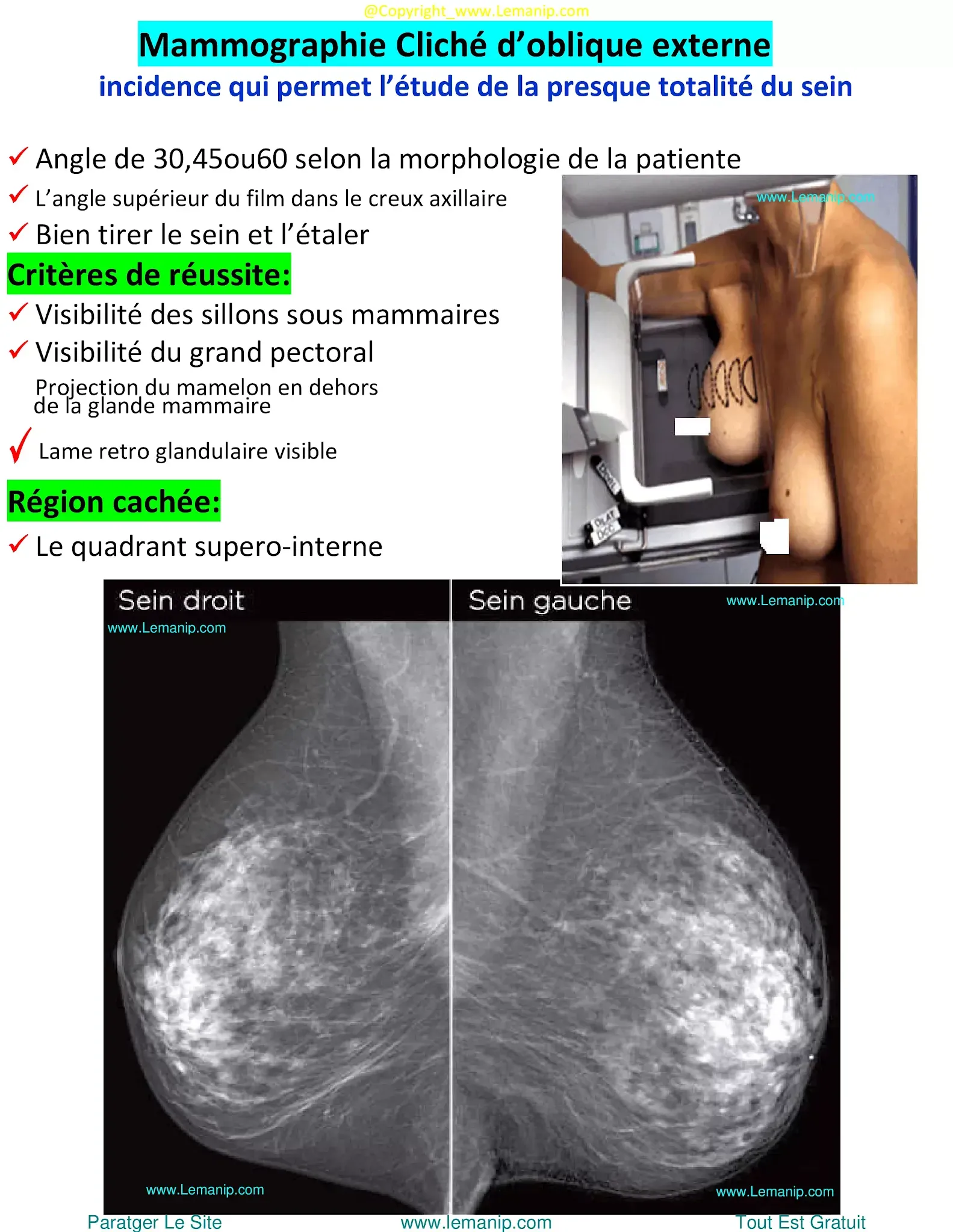 westmed mammogram,fda mammography facilities,nancy ausonio mammography center,tully center mammogram,jefferson mammogram,legacy mammogram,baystate mammography,reflections mammogram,ohana mammography,mammogram on period,mammo,mammographer