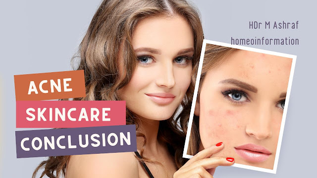 Acne Skin Care For Women Tips and Tricks - Conclusion